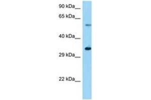 Image no. 1 for anti-Ubiquitin Specific Peptidase 27, X-Linked (USP27X) (AA 91-140) antibody (ABIN6748295) (USP27X anticorps  (AA 91-140))