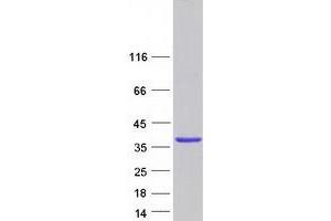 Validation with Western Blot