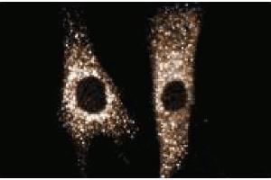 Immunofluorescent staining of Hs68 cells.