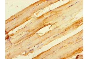 Immunohistochemistry of paraffin-embedded human skeletal muscle tissue using ABIN7154917 at dilution of 1:100 (HSPB7 anticorps  (AA 1-170))