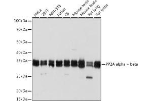 Western blot analysis of extracts of various cell lines, using PP2A alpha + beta Rabbit mAb (ABIN7269686) at 1:1000 dilution.
