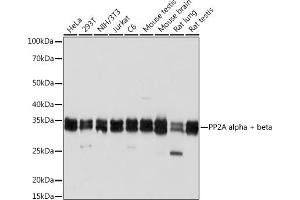 Western blot analysis of extracts of various cell lines, using PP2A alpha + beta Rabbit mAb (ABIN7269686) at 1:1000 dilution. (PPP2CB anticorps)