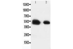 Anti-Glucose Transporter 8 antibody, Western blotting Lane 1: Rat Testis Tissue Lysate Lane 2: Human Placenta Tissue Lysate