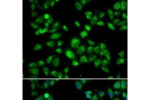 Immunofluorescence analysis of U2OS cells using MBTPS1 Polyclonal Antibody (MBTPS1 anticorps)