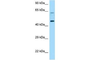 WB Suggested Anti-CRHR1 Antibody Titration: 1. (CRHR1 anticorps  (C-Term))