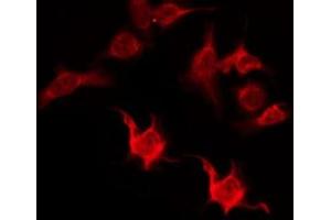 ABIN6276169 staining HepG2 by IF/ICC.