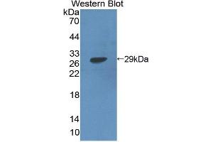 Western blot analysis of the recombinant protein. (NR5A2 + LRH1 anticorps  (AA 300-541))