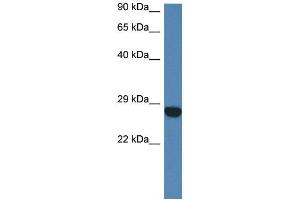 WB Suggested Anti-Ccdc90b Antibody   Titration: 1. (CCDC90B anticorps  (N-Term))