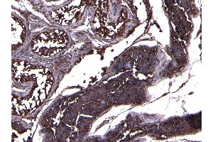 (ABIN7505817) (8 μg/mL) staining of paraffin embedded Human Testis.
