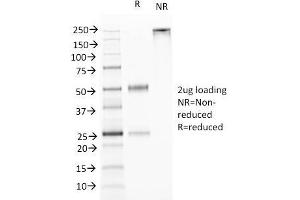 SDS-PAGE Analysis Purified TNFS15 / VEGI Monoclonal Antibody (VEGI /1283). (TNFSF15 anticorps)