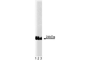 Western blot analysis of caveolin-1 (pY14) on lysates from A431 cells (Human epithelial carcinoma, ATCC CRL-1555) treated with 100 ng/mL EGF. (Caveolin anticorps  (pTyr14))