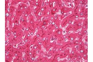 Anti-Haptoglobin antibody IHC of human liver. (Haptoglobin anticorps  (AA 19-406))