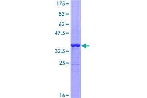Image no. 1 for Zinc Finger Protein 278 (ZNF278) (AA 260-358) protein (GST tag) (ABIN1314058)