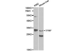 Western blot analysis of extracts of various cell lines, using TPMT antibody. (TPMT anticorps)
