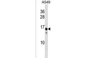 KRAB-related domain-containing protein Antibody (N-term) (ABIN1538891 and ABIN2838089) western blot analysis in A549 cell line lysates (35 μg/lane). (SSX11 (AA 1-30), (N-Term) anticorps)