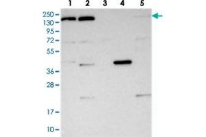 Western blot analysis of Lane 1: RT-4, Lane 2: U-251 MG, Lane 3: Human Plasma, Lane 4: Liver, Lane 5: Tonsil with POLR2B polyclonal antibody  at 1:250-1:500 dilution. (POLR2B anticorps)