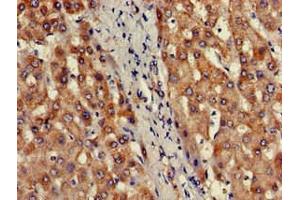 Immunohistochemistry of paraffin-embedded human liver tissue using ABIN7164093 at dilution of 1:100