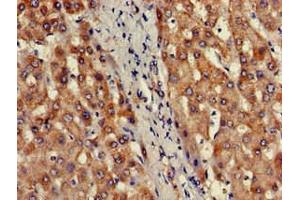 Immunohistochemistry of paraffin-embedded human liver tissue using ABIN7164093 at dilution of 1:100 (PRDM2 anticorps  (AA 733-961))