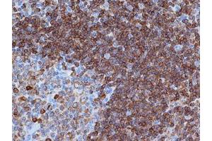 Immunohistochemistry (IHC) image for anti-B-cell antigen receptor complex-associated protein alpha chain (CD79A) (AA 202-216) antibody (ABIN316539)