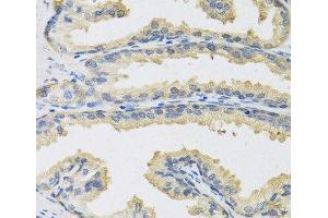 Immunohistochemistry of paraffin-embedded Human prostate using CST3 Polyclonal Antibody at dilution of 1:100 (40x lens). (CST3 anticorps)