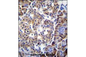 SMYD4 Antibody immunohistochemistry analysis in formalin fixed and paraffin embedded human pancreas tissue followed by peroxidase conjugation of the secondary antibody and DAB staining. (SMYD4 anticorps  (C-Term))
