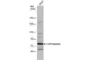 WB Image TCP1 epsilon antibody detects TCP1 protein by western blot analysis. (CCT5 anticorps)