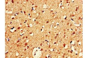 IHC image of ABIN7148735 diluted at 1:600 and staining in paraffin-embedded human brain tissue performed on a Leica BondTM system.