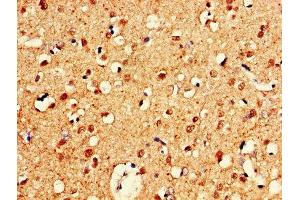 IHC image of ABIN7148735 diluted at 1:600 and staining in paraffin-embedded human brain tissue performed on a Leica BondTM system. (CELF2 anticorps  (AA 291-381))