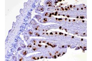 IHC analysis of CD252 using anti-CD252 antibody .