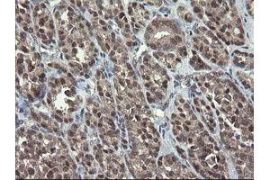 Image no. 3 for anti-Golgin, RAB6-Interacting (GORAB) (AA 35-394) antibody (ABIN1491441)