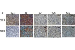 Prostate tumors grown from Cav1-silenced PC3 cells were accompanied by a more reactive tumor stroma. (PCNA anticorps)
