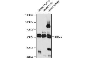 anti-BTB (POZ) Domain Containing 1 (BTBD1) (C-Term) antibody