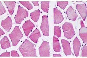 Human Skeletal Muscle: Formalin-Fixed, Paraffin-Embedded (FFPE)