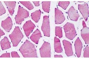 Human Skeletal Muscle: Formalin-Fixed, Paraffin-Embedded (FFPE) (ATP5O anticorps  (AA 38-64))