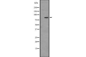Western blot analysis of ZBTB16 expression in HL60 (Human promyelocytic leukemia cell line) Whole Cell Lysate,The lane on the left is treated with the antigen-specific peptide. (ZBTB16 anticorps  (Internal Region))