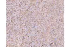 IHC analysis of PTN using anti-PTN antibody (ABIN7602164). (Pleiotrophin anticorps  (AA 61-148))