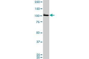 MCM3 monoclonal antibody (M01A), clone 4F7. (MCM3 anticorps  (AA 699-808))