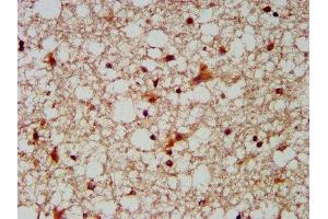 IHC image of ABIN7148695 diluted at 1:300 and staining in paraffin-embedded human brain tissue performed on a Leica BondTM system. (MUS81 anticorps  (AA 82-265))