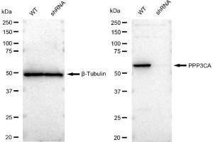 Western blotting analysis using PPP3CA antibody (ABIN7800026).