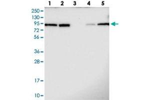 Western blot analysis of Lane 1: RT-4, Lane 2: U-251 MG, Lane 3: Human Plasma, Lane 4: Liver, Lane 5: Tonsil with TBL3 polyclonal antibody  at 1:100-1:250 dilution.