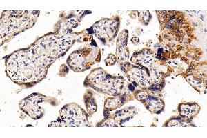 Detection of CK17 in Human Placenta Tissue using Polyclonal Antibody to Cytokeratin 17 (CK17)