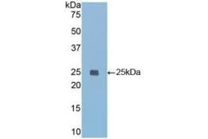 Detection of Recombinant IGFBP7, Mouse using Polyclonal Antibody to Insulin Like Growth Factor Binding Protein 7 (IGFBP7)