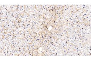 Detection of ICAM1 in Human Liver Tissue using Monoclonal Antibody to Intercellular Adhesion Molecule 1 (ICAM1)