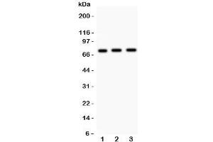 Western blot testing of Myb antibody and human samples 1:  placenta;  2: SMMC-7721;  3: HeLa lysate. (MYB anticorps  (AA 1-201))