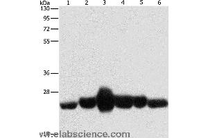 Western blot analysis of Human fetal muscle and fetal lung tissue, Human leiomyosarcoma tissue, mouse lung and heart tissue,  NIH/3T3 cell, using CAV1 Polyclonal Antibody at dilution of 1:550
