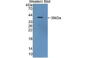Detection of Recombinant GCPII, Porcine using Polyclonal Antibody to Prostate-specific Membrane Antigen (PMSA)