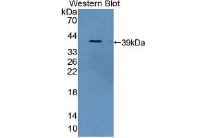 Detection of Recombinant GCPII, Porcine using Polyclonal Antibody to Prostate-specific Membrane Antigen (PMSA) (PSMA anticorps  (AA 275-588))