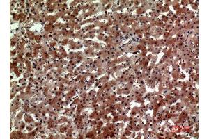 Immunohistochemistry (IHC) analysis of paraffin-embedded Human Liver, antibody was diluted at 1:100.