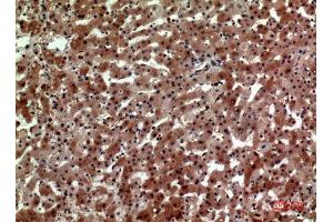 Immunohistochemistry (IHC) analysis of paraffin-embedded Human Liver, antibody was diluted at 1:100. (CD163L1 anticorps  (Internal Region))