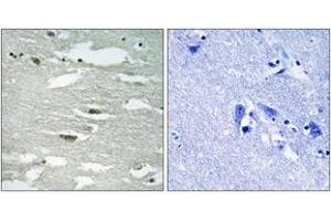 Immunohistochemistry analysis of paraffin-embedded human brain, using ILK (Phospho-Ser246) Antibody. (ILK anticorps  (pSer246))